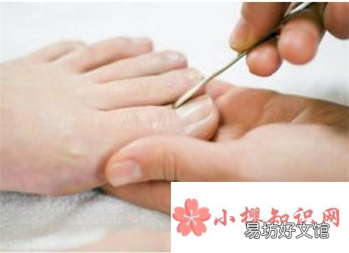 脚指甲变厚怎么办