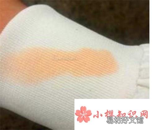 防晒霜弄衣服上怎么洗