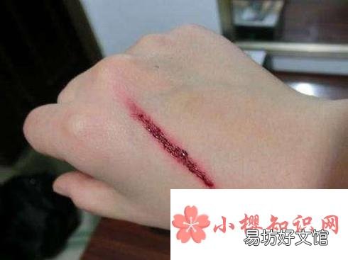 花露水能直接涂身上吗？如何正确使用花露水