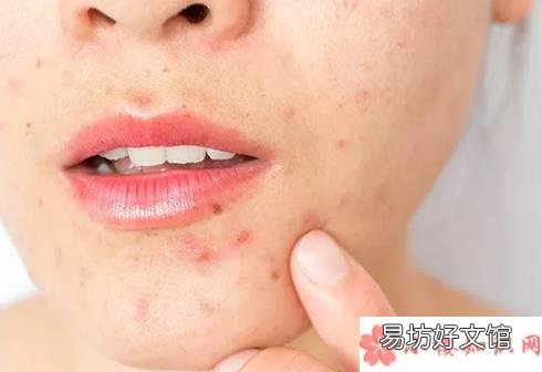 大家戴口罩谁最害怕 疫情过后谁最害怕口罩