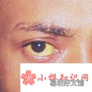 金瞳是什么?