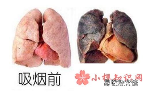 经常抽烟的危害有哪些?