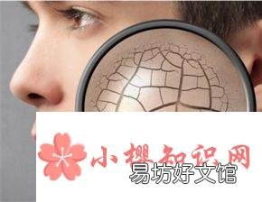 桂皮的忌食人群