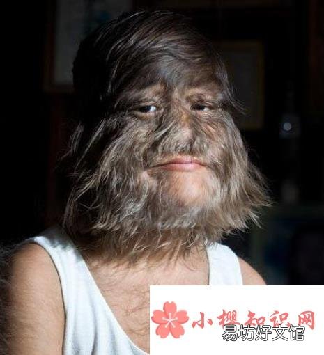 世界十大兽孩