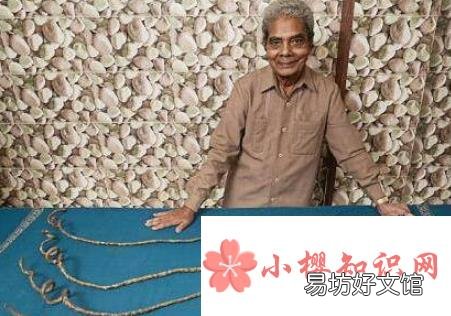 世界上最长的指甲