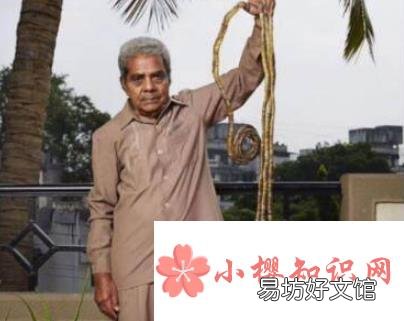 世界上最长的指甲