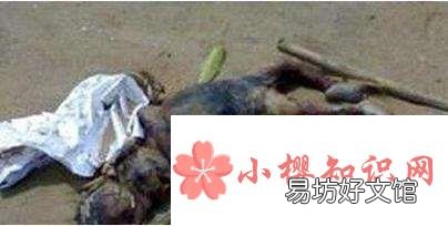 人为什么会死
