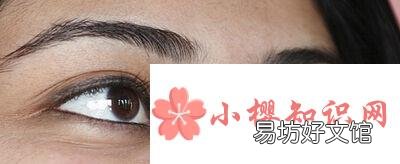 黑眼圈重是身体哪里出现问题?