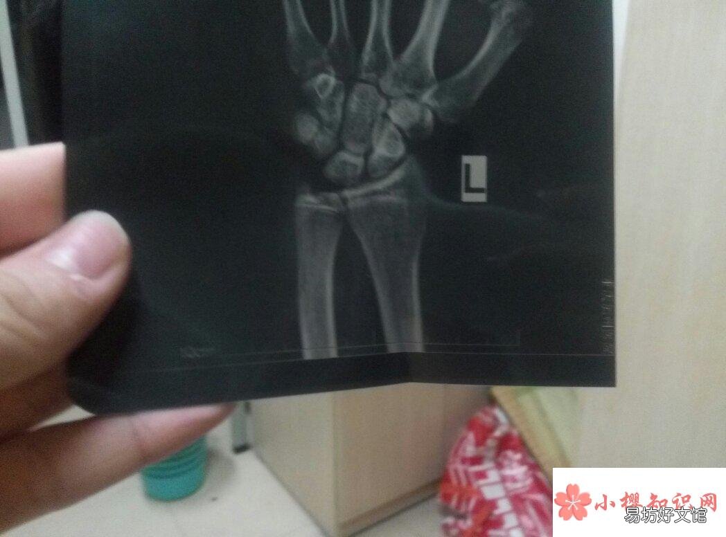 判断骨骼闭合小方法有哪些?