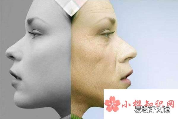 诺维斯是什么？