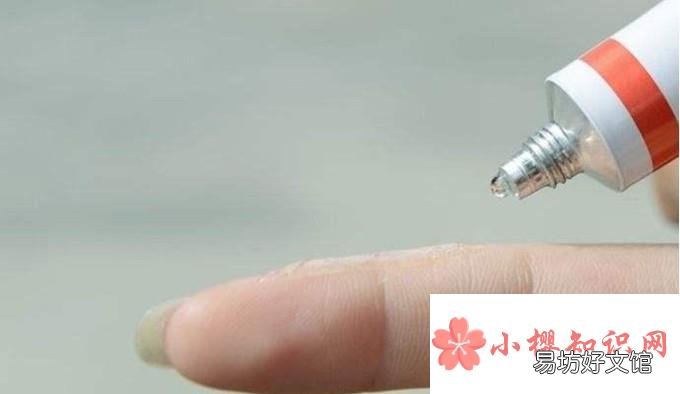 手上的湿疹的治疗方法