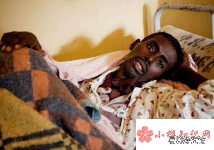 怎么判断一个人艾滋病