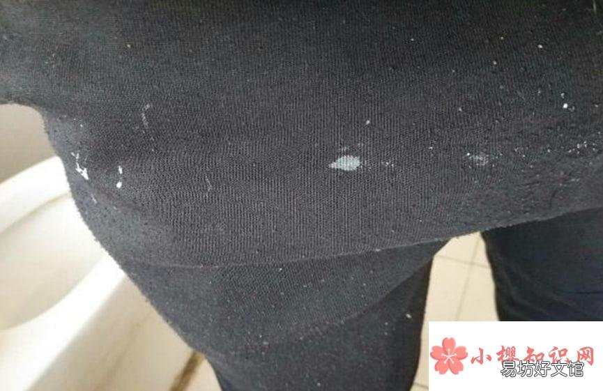 黑裤子上的白胶怎么样才能洗掉
