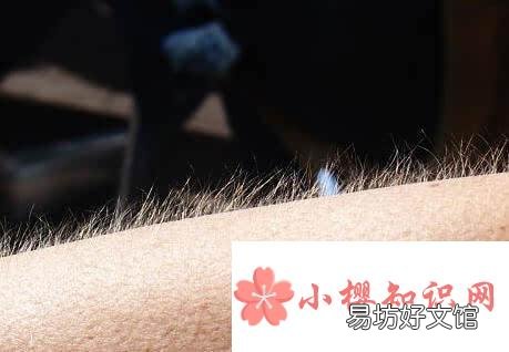 冷了身上为什么会起鸡皮疙瘩？