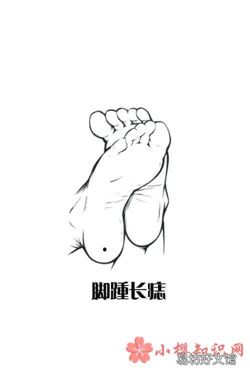 全面解析脚上的痣
