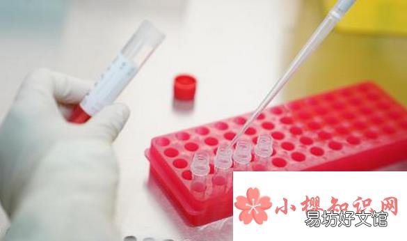 核酸检测多少钱?