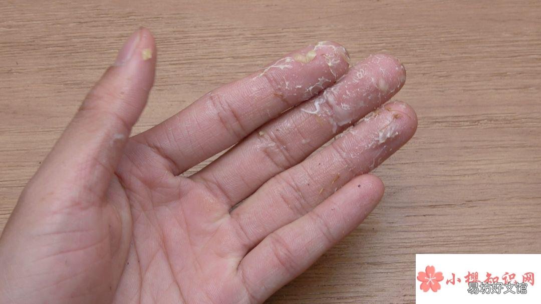 502沾了手上怎么弄掉?
