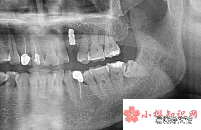 口腔医学技术是学什么的?