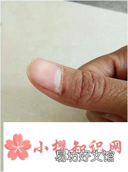 指甲长到肉里怎么办