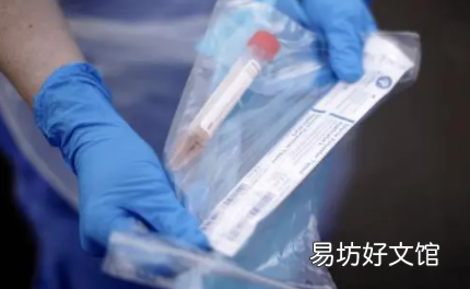 2022春节返京人员需要核酸检测吗