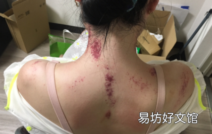第一次和第二次刮痧相隔多久