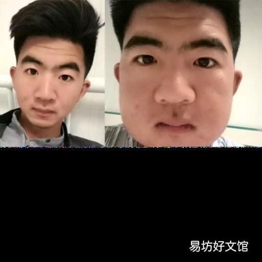 最难拔的智齿图 怎么拔智齿