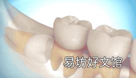 最难拔的智齿图 怎么拔智齿
