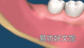 最难拔的智齿图 怎么拔智齿