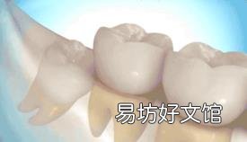 最难拔的智齿图 怎么拔智齿