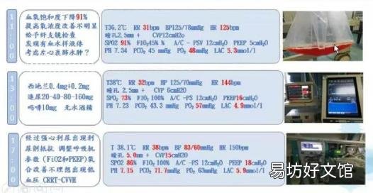 医学引流量是什么 怎么引流量