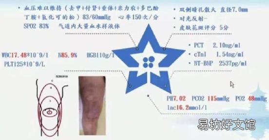 医学引流量是什么 怎么引流量