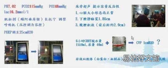 医学引流量是什么 怎么引流量
