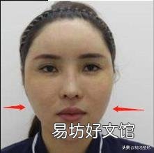 脸太瘦凹进去怎么办 脸太瘦凹进去怎么增肥