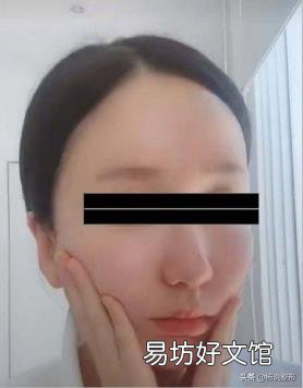 脸太瘦凹进去怎么办 脸太瘦凹进去怎么增肥