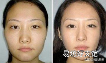 脸太瘦凹进去怎么办 脸太瘦凹进去怎么增肥