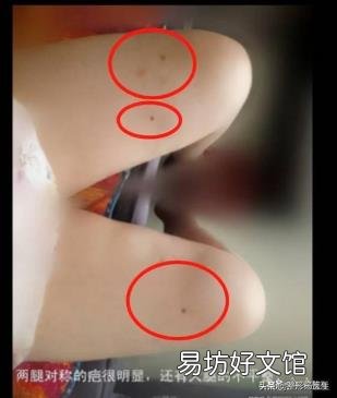 脸太瘦凹进去怎么办 脸太瘦凹进去怎么增肥