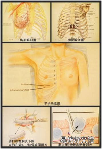 中国最好的下颌角医生张笑天 张笑天整形怎么样