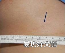 中国最好的下颌角医生张笑天 张笑天整形怎么样