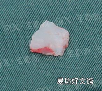 中国最好的下颌角医生张笑天 张笑天整形怎么样