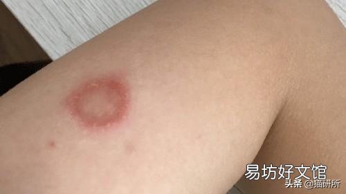 猫癣症状及图片大全(猫癣症状早期图片)