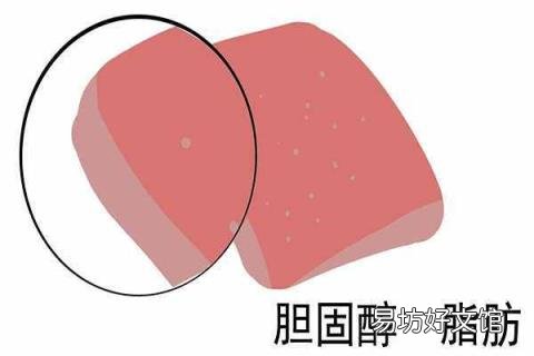 胆固醇正常值对照表 胆固醇标准值是多少