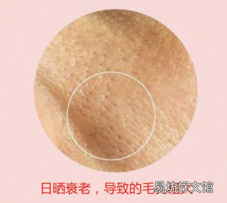 女人毛孔粗大怎么办 女生毛孔粗大