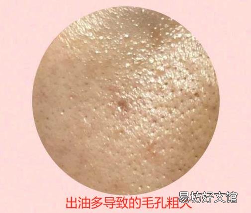 女人毛孔粗大怎么办 女生毛孔粗大