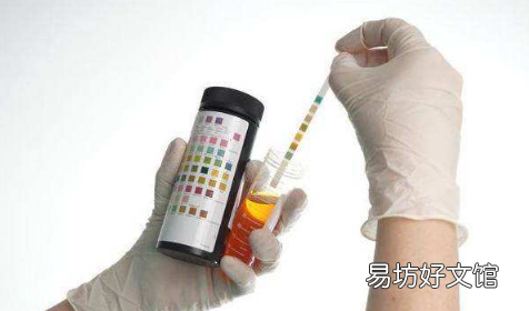 有高尿酸一辈子不发病的人吗