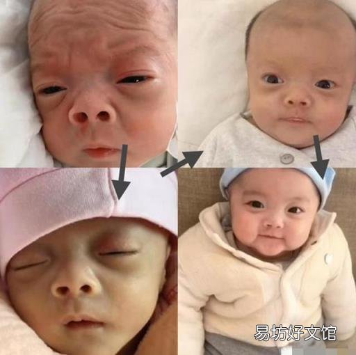 产妇生下“外星宝宝”被吓哭 外星婴儿