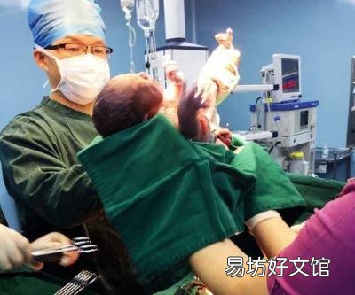 产妇生下“外星宝宝”被吓哭 外星婴儿
