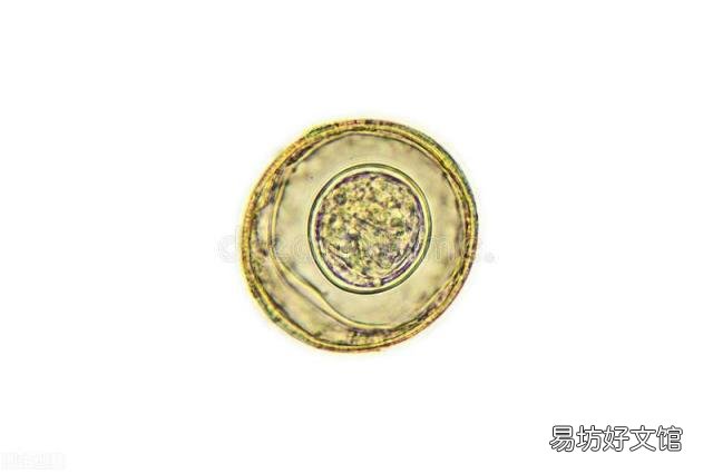 怎么知道肚子里有沒(méi)有蛔蟲(chóng)？ 肚子里有蛔蟲(chóng)