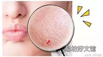 四步走解决毛孔粗大难题,适用于各种肤质! 皮肤毛孔大