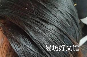 施巴洗发水好用吗 施巴怎么样