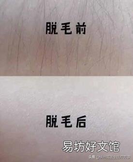脱毛间隔多久一次 激光脱毛多长时间一次